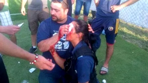 FOTO INCREDIBIL: O imagine care produce indignare!** O femeie jandarm a fost umplută de sânge la un meci din România! Vezi ce s-a întâmplat