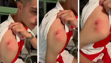 Poliția din Germania a dat-o în urmărire pe femeia care l-a mușcat pe un fan! Totul s-a petrecut în timpul unei bătăi de la EURO când atacantul și-a aruncat tricoul în tribună!