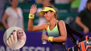 Cât GHINION! Accidentare oribilă pentru Cîrstea. Imagine HORROR: cum arată degetul fracturat al Soranei. FOTO