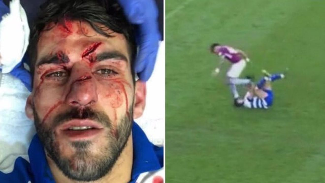Jucătorul care l-a cotonogit pe Zlatan recidivează! Cum arată fața atacantului de la Reading după intervenția criminală: "Mă simt groaznic!"