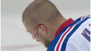 "This is hockey": 13 copci pentru ca medicii să îi coasă o parte a urechii la loc. A revenit pe gheață și a dat golul victoriei