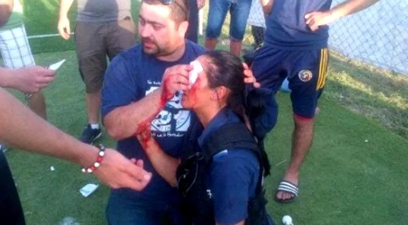 FOTO INCREDIBIL: O imagine care produce indignare!** O femeie jandarm a fost umplută de sânge la un meci din România! Vezi ce s-a întâmplat