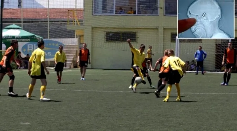 Poveste incredibilă petrecută în Bosnia: un portar a jucat 90 de minute cu un glonț în cap!