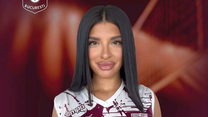 Ce a pățit voleibalista Daniela Simion pe internet: „Dacă de la 19 ani își bagă acid în buze...”