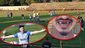 Unul dintre jucătorii acuzați de blat de echipa sa, desfigurat în partida din Liga 3 pe care ar fi pariat. ”Costă 50.000 de lei toată intervenția”. Imagini cu puternic impact emoțional