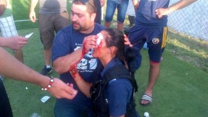 FOTO INCREDIBIL: O imagine care produce indignare!** O femeie jandarm a fost umplută de sânge la un meci din România! Vezi ce s-a întâmplat