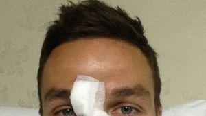 FOTO Szukala, de nerecunoscut!** Fundașul face haz de noul său look de războinic: "Hattrick! Acum știu ce simte un boxer" Cum arată acum stelistul