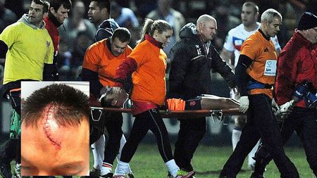 "E doar o zgârietură! Oricum voiam să-mi schimb look-ul"** Accidentare șocantă în Anglia! FOTO Cum arăta înainte și după: