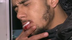 Moment incredibil în Liga 1! L-au scos accidentat de pe teren, dar cei de pe ambulanță nu au vrut să-l ducă la spital: "Nu ai acte? Hai că facem în felul următor, că nu e urgență, nu moare"