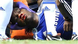 Drogba, primul interviu după accidentarea HORROR:** "Mă sperii când văd imaginile cu mine plin de sânge"