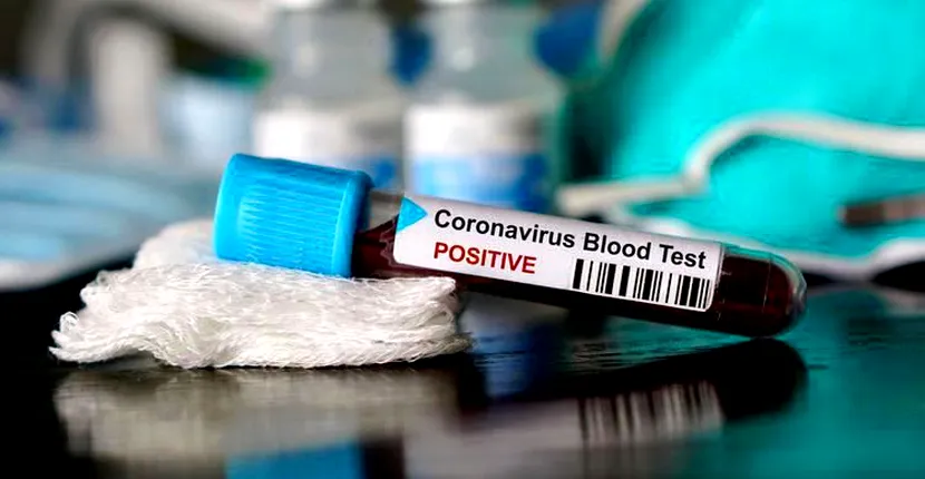 Bilanțul coronavirusului în România: 1.256 de cazuri în ultimele 24 de ore