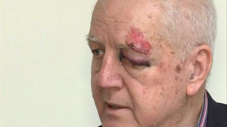 INCREDIBIL! Pădureanu a fost JEFUIT în plină zi, pe o stradă din Capitală!** Șeful Gloriei s-a lovit grav în zona capului: "Îi cinstesc dacă îmi returnează ștampila!"