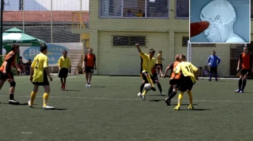 Poveste incredibilă petrecută în Bosnia: un portar a jucat 90 de minute cu un glonț în cap!