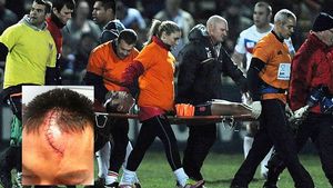 "E doar o zgârietură! Oricum voiam să-mi schimb look-ul"** Accidentare șocantă în Anglia! FOTO Cum arăta înainte și după: