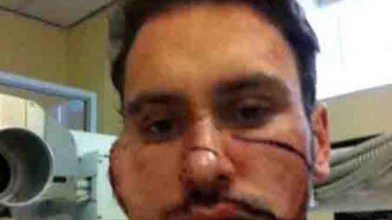 Instructorul de înot bătut cu bestialitate de iubită a revenit în bazin. FOTO - Cum s-a recuperat