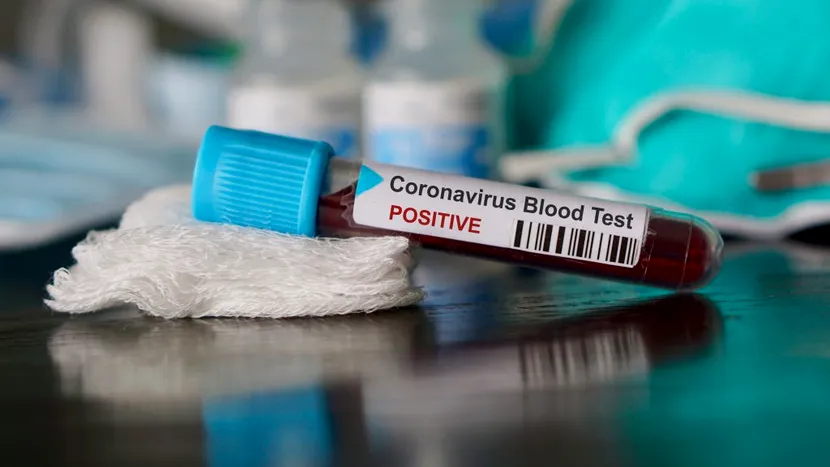 Primul caz de coronavirus în România! Cum se simte bolnavul din județul Gorj