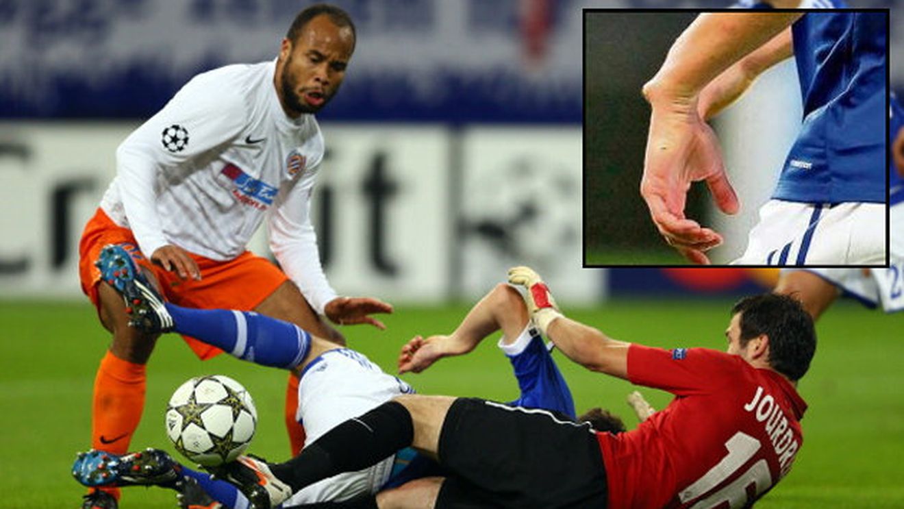 E cel mai tânăr neamț care a marcat în Ligă, dar nu s-a putut bucura! ** Draxler a fost operat, după ce i-a șocat pe toți cu accidentarea sa