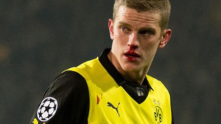 Eroul însângerat al Borussiei! A schimbat toate cele trei tricouri de rezervă și a jucat cu un echipament din magazinul clubului