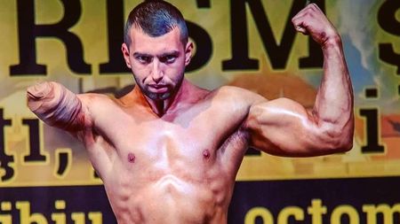 Lecție de viață! O „sărăriță” i-a smuls brațul, iar în culturism a găsit puterea de a nu renunța. FOTO ȘI VIDEO IMPRESIONANTE