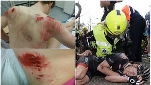 VIDEO + FOTO | Ce înseamnă o căzătură în ciclism. Care sunt urmările unuia dintre cele mai teribile incidente din plutonul profesionist din ultimii ani
