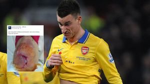 FOTO: Koscielny și-a pozat genunchiul rupt în meciul cu City și a postat imaginea pe Facebook