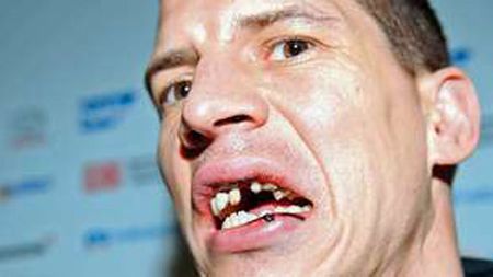 Vezi cum arată omul care a marcat cel mai nedorit gol!