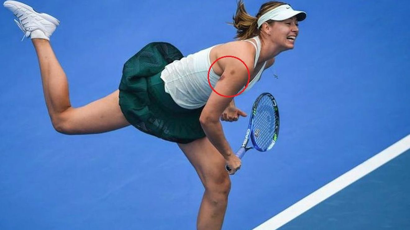 Șarapova și-a liniștit fanii. De unde provin vânătăile de pe brațul drept și ce spune Maria despre o posibilă finală cu Halep