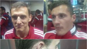 "Stewarzii au sărit să ne bată". Ca după război! FOTO - Rănile suferite de jucătorii Albaniei după "războiul" de la Belgrad. Fotbaliștii, primiți ca niște eroi la revenirea la Tirana | VIDEO