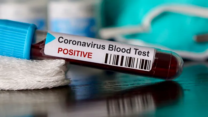 Un vaccin pentru coronavirus testat pe șoareci, rezultate încurajatoare!