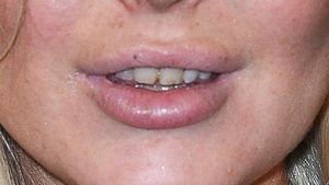 FOTO: O recunoști? Așa arăta în urmă cu doi ani. Schimbare RADICALĂ‚: Uite ce buze sexy are acum