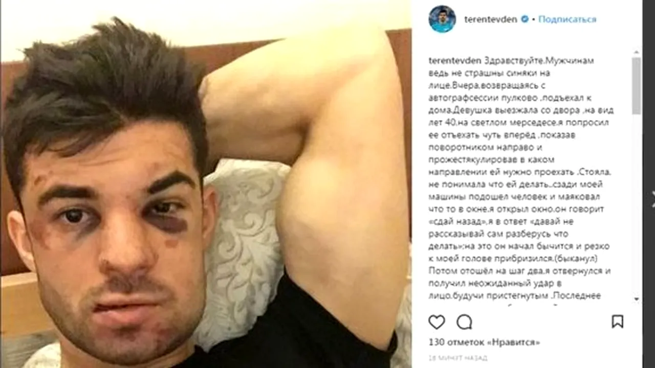 Violență fără margini în Rusia! Un fotbalist de la Zenit a fost bătut în plină stradă dintr-un motiv absurd | FOTO