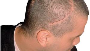 Chivu** a lovit mingea cu capul