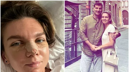 Simona Halep a spus tot adevărul! De ce și-a făcut rinoplastie chiar după divorț și motivul pentru care și-a modificat forma nasului: „Nu-mi plăcea deloc!” FOTO