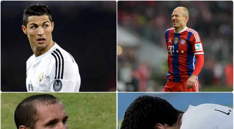 VIDEO | Ronaldo, Robben și Suarez, devansați de un anonim din liga secundă engleză în topul celor mai penibile simulări ale anului 2014