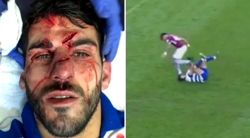 Jucătorul care l-a cotonogit pe Zlatan recidivează! Cum arată fața atacantului de la Reading după intervenția criminală: 