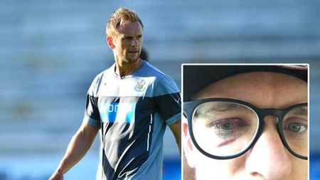 Accidentare bizară suferită de Siem de Jong în timpul antrenamentului! Starul lui Newcastle s-a temut că și-ar putea pierde vederea