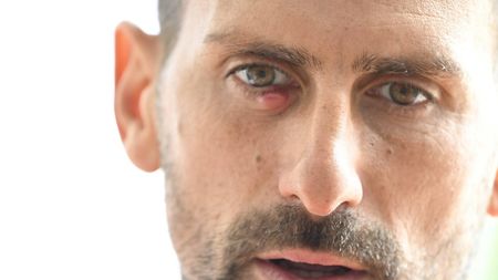 Novak Djokovic a vorbit despre misterul ochiului său umflat