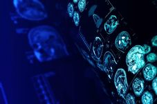 Ce controverse! Preotului neurochirurg care l-a operat pe Gigi Becali i s-au pus &icirc;n c&acirc;rc&#259; multe acuza&#539;ii