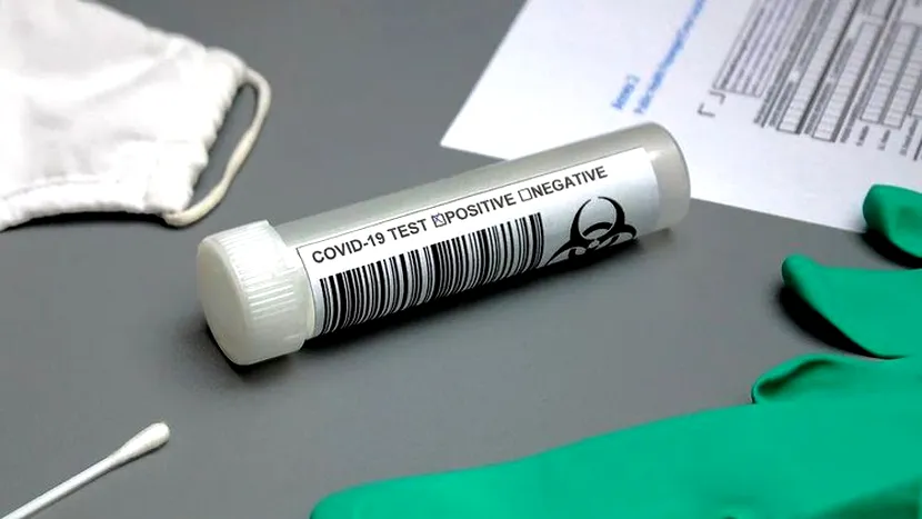 9.937 de noi îmbolnăviri cu coronavirus în ultimele 24 de ore în România