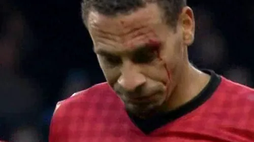Fanii lui City au explodat de furie, după golul din prelungiri! VIDEO:** Rio Ferdinand a fost lovit cu o monedă și a încheiat meciul plin de sânge