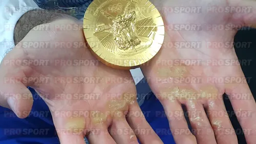 Palme de aur! Imaginile muncii răsplătite: așa arată mâinile campionului olimpic Marian Enache, brăzdate de bătături ca Parisul de râul Sena. EXCLUSIV