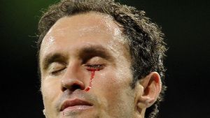 VIDEO&FOTO ȘOCANT** Carvalho, cu "lacrimi" de sânge, după ce a primit un cot în ochi de la un adversar