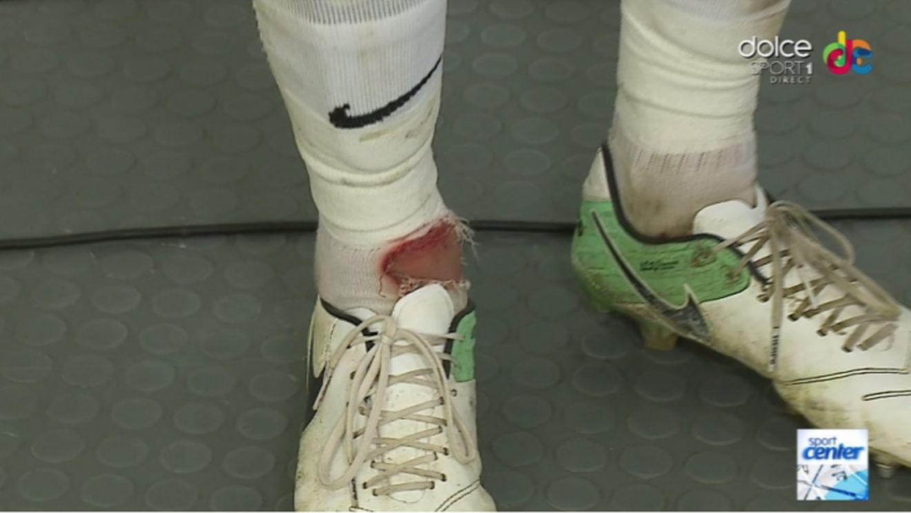 Merita Alibec al doilea galben? "A venit cu talpa sus, direct pe gleznă". Ce a spus "victima" atacantului imediat după FCSB - Botoșani 2-0