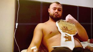 Decizie șoc luată de românul desfigurat în palme pentru câteva mii de euro: ce vrea să facă pentru bani! | EXCLUSIV