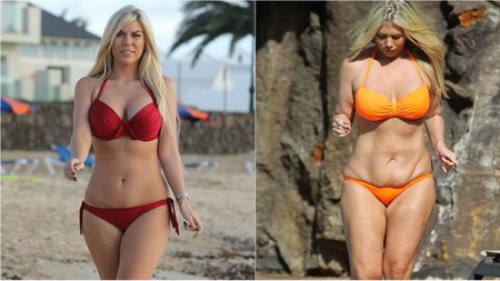 Pericolele dietei dusă la extrem! FOTO INCREDIBIL | Efect "yo-yo" pentru o vedetă de 28 de ani. Cum s-a transformat în 10 luni
