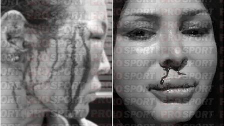 Dinamo și Federația de Baschet au angajat pe mii de euro un antrenor grec acuzat la Atena de fosta sa prietenă de vătămare corporală gravă, furt și consum de droguri! Femeia a relatat cum a fost strangulată, înjunghiată și a avortat din cauza bătăilor primite. Manolis Papamakarios a venit în România pe filiera Vlad Moldoveanu - Carmen Tocală | SPECIAL