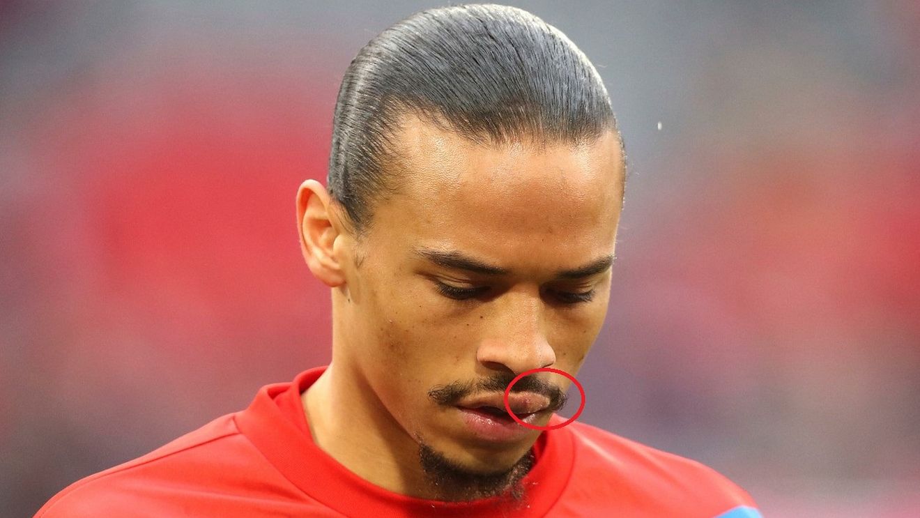 Cum arată Leroy Sane după ce a fost bătut de Sadio Mane în vestiarul lui Bayern! Prima apariție a neamțului | FOTO