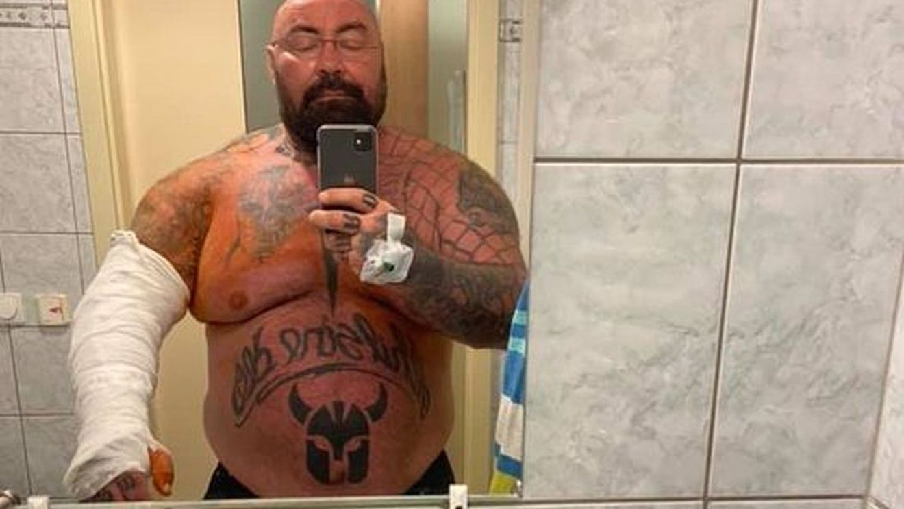 Sandu Lungu, din nou operat! Atenție, imagini cu puternic impact emoțional