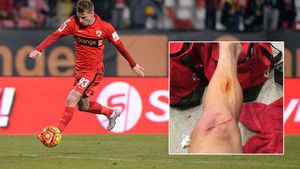 FOTO ȘOCANT | Cum arată piciorul lui Vali Lazăr după intrarea la care Stan a văzut roșu direct. "Nu e nimic rupt..."