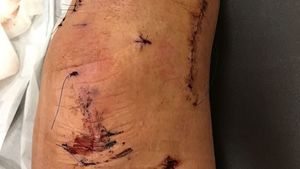 "Leul" Ibrahimovic, la aproape șase luni după revenirea pe gazon: "Mi-au spus că s-a terminat..."